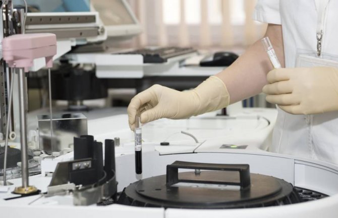 U Crnoj Gori otkriveno još 426 slučajeva koronavirusa, preminule četiri osobe