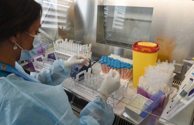 Dva pacijenta preminula, 375 novooboljelih