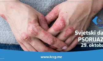 Pregledi bez uputa i zakazivanja za oboljele od psorijaze